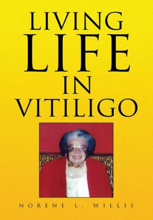 Book cover of Living Life in Vitiligo