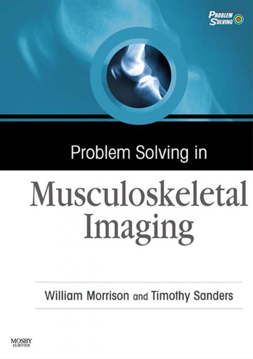 Cover of the book Problem Solving in Musculoskeletal Imaging E-Book by William B. Morrison, MD, Timothy G. Sanders, MD, Elsevier Health Sciences