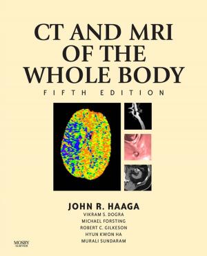 Cover of the book Computed Tomography & Magnetic Resonance Imaging Of The Whole Body E-Book by Ann B. Hamric, Charlene M. Hanson, Mary Fran Tracy, Eileen T. O'Grady