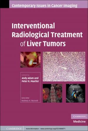 Cover of the book Interventional Radiological Treatment of Liver Tumors by 