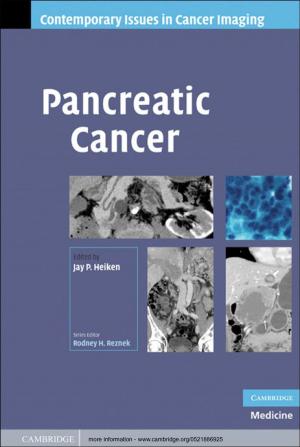 Cover of the book Pancreatic Cancer by Vincenzo Pecunia, Marco Fattori, Sahel Abdinia, Henning Sirringhaus, Eugenio Cantatore