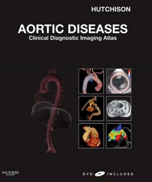 Cover of the book Aortic Diseases E-Book by Paul M. Paulman, MD, Audrey Paulman, MD, Jeffrey D. Harrison, MD, Laeth S. Nasir, MD, Sarah K. Bryan, BA, Dean S. Collier, PharmD, BCPS, Mark A. Davis, MD, MS