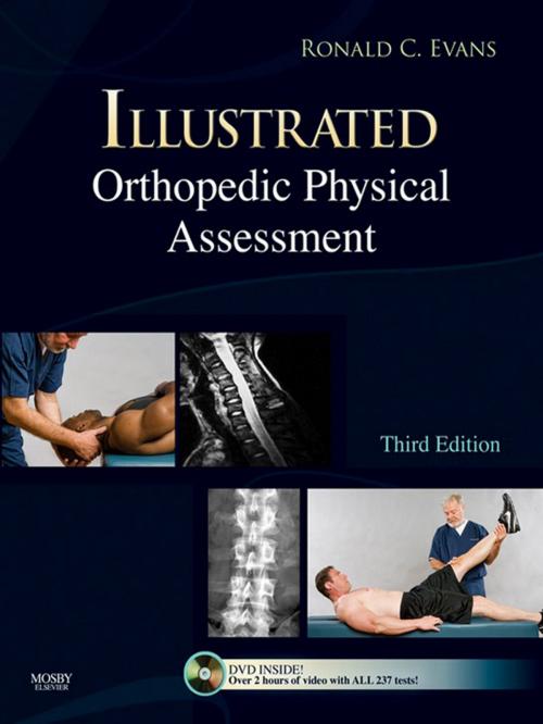 Cover of the book Illustrated Orthopedic Physical Assessment by Ronald C. Evans, Elsevier Health Sciences