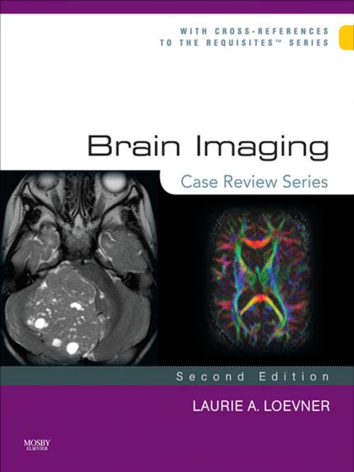 Cover of the book Brain Imaging: Case Review Series E-Book by Laurie A. Loevner, MD, Elsevier Health Sciences