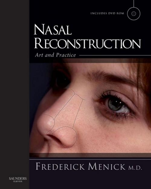 Cover of the book Nasal Reconstruction: Art and Practice by Frederick J. Menick, Elsevier Health Sciences UK
