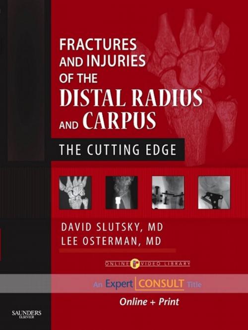 Cover of the book Fractures and Injuries of the Distal Radius and Carpus E-Book by David J. Slutsky, MD, FRCS, A. Lee Osterman, MD, Elsevier Health Sciences