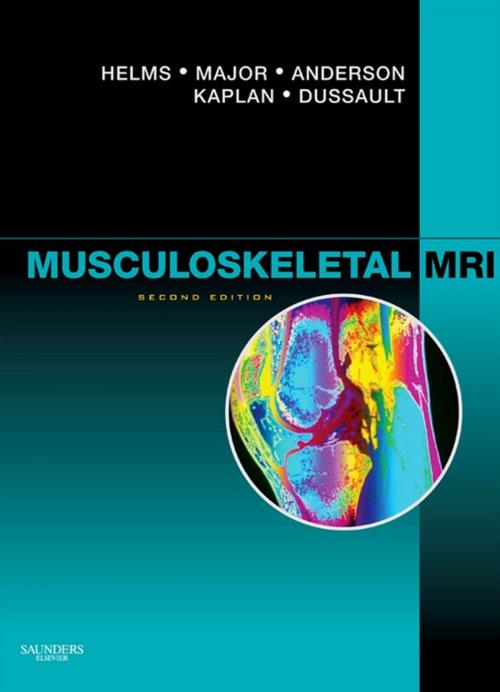 Cover of the book Musculoskeletal MRI E-Book by Clyde A. Helms, MD, Nancy M. Major, MD, Mark W. Anderson, MD, Phoebe Kaplan, MD, Robert Dussault, MD, Elsevier Health Sciences