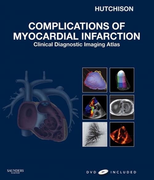 Cover of the book Complications of Myocardial Infarction E-Book by Stuart J. Hutchison, MD, FRCPC, FACC, FAHA, FASE, FSCMR, FSCCT, Elsevier Health Sciences