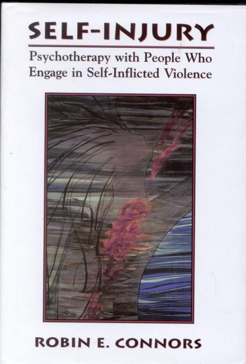 Cover of the book Self-Injury by Robin E. Connors, Jason Aronson, Inc.