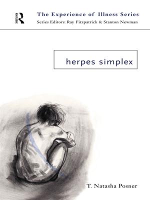 Cover of the book Herpes Simplex by Ellen S. Silber