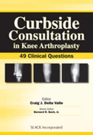 Cover of the book Curbside Consultation in Knee Arthroplasty by Peter Kloen, Ren K. Marti