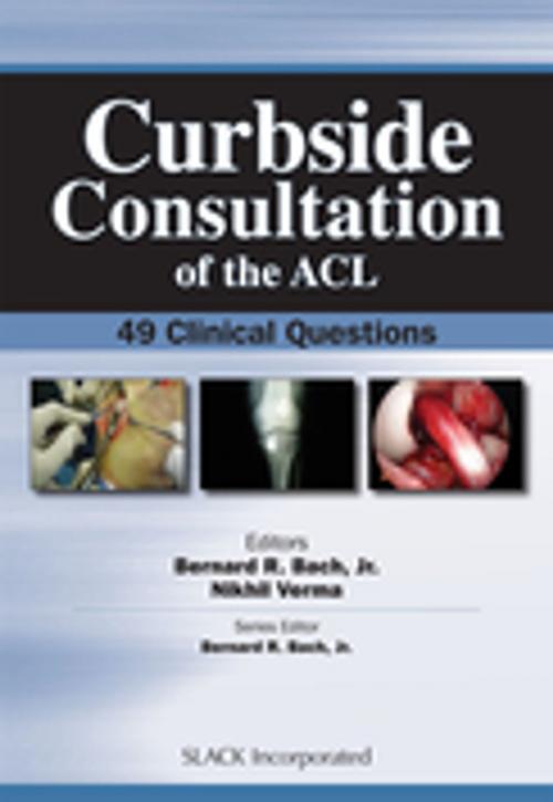 Cover of the book Curbside Consultation of the ACL by , SLACK Incorporated