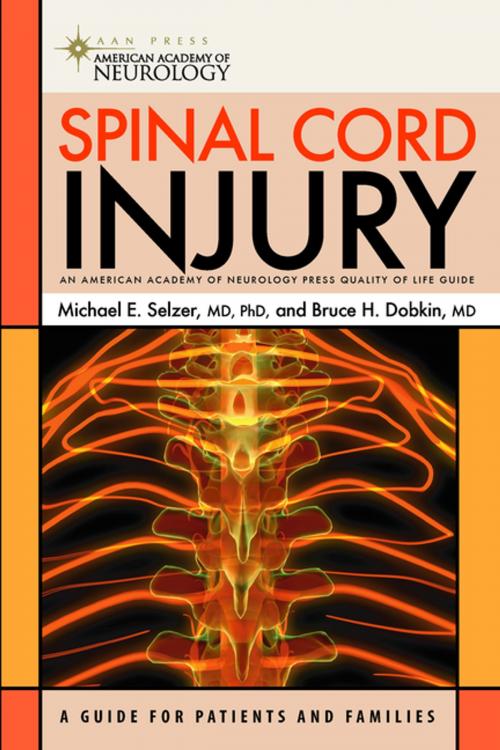 Cover of the book Spinal Cord Injury by Bruce H. Dobkin, MD, FRCP, Michael E. Selzer, MD, PhD, Springer Publishing Company