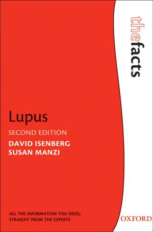 Cover of the book Lupus by Simon Usherwood, John Pinder
