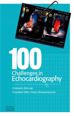 Cover of the book 100 Challenges in Echocardiography E-Book by Carolyn Jarvis, PhD, APN, CNP