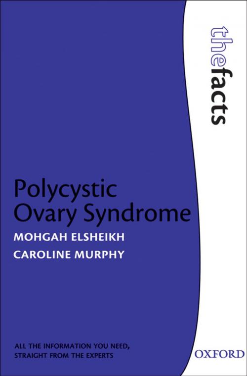 Cover of the book Polycystic Ovary Syndrome by Mohgah Elsheikh, Caroline Murphy, OUP Oxford