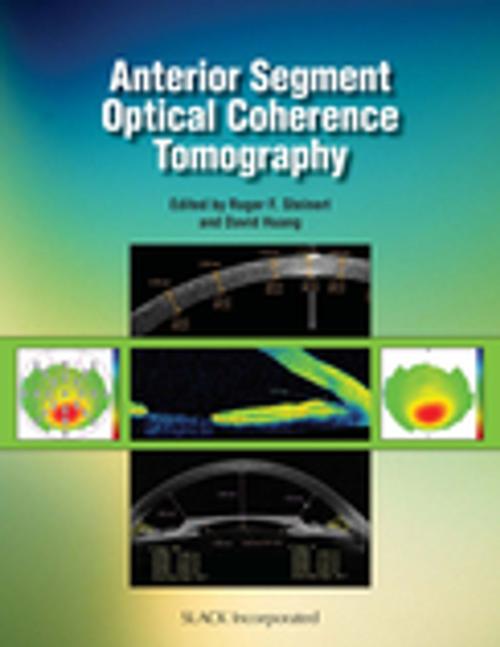 Cover of the book Anterior Segment Optical Coherence Tomography by , SLACK Incorporated