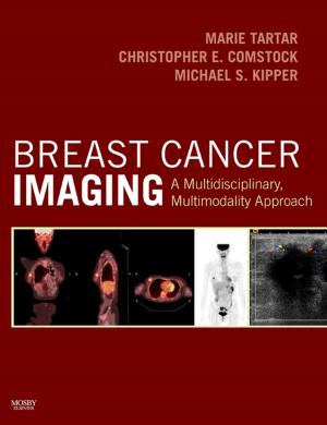 Cover of the book Breast Cancer Imaging E-Book by Vishram Singh