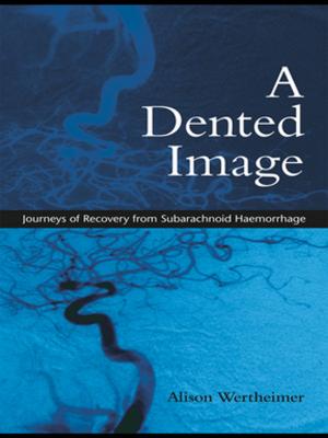 Book cover of A Dented Image