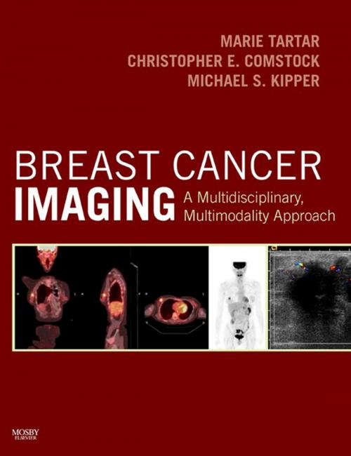Cover of the book Breast Cancer Imaging E-Book by Marie Tartar, MD, Christopher E. Comstock, MD, Michael S. Kipper, MD, Elsevier Health Sciences