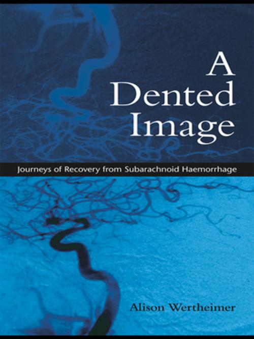 Cover of the book A Dented Image by Alison Wertheimer, Taylor and Francis