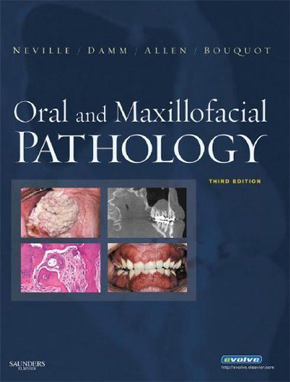 Big bigCover of Oral and Maxillofacial Pathology - E-Book