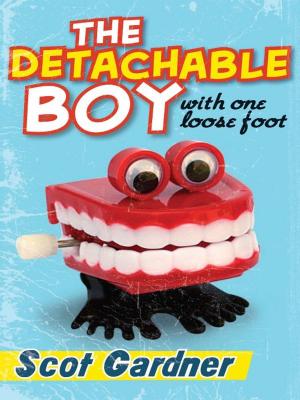 Cover of the book The Detachable Boy by Martin Hawes, Joan Baker