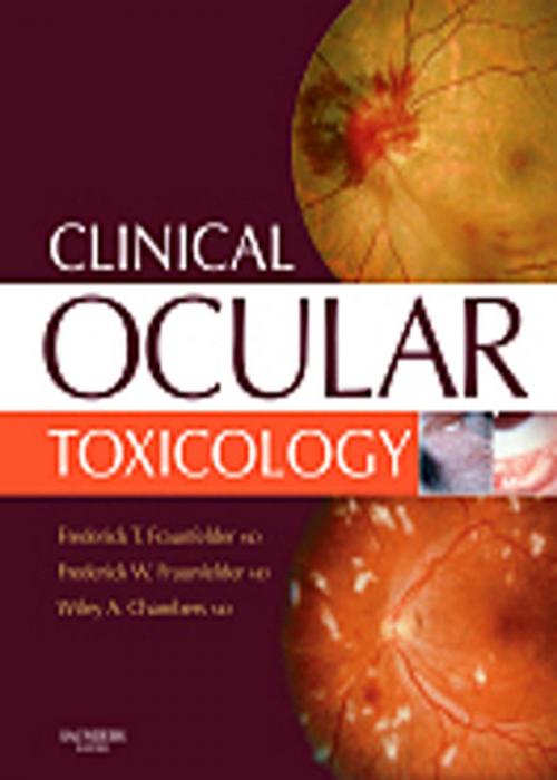 Cover of the book Clinical Ocular Toxicology E-Book by Wiley A. Chambers, Frederick T. Fraunfelder, MD, Frederick W. Fraunfelder Jr., MD, M.B.A, Elsevier Health Sciences