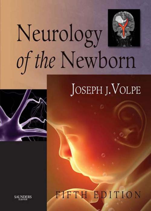Cover of the book Neurology of the Newborn E-Book by Joseph J. Volpe, MD, Elsevier Health Sciences