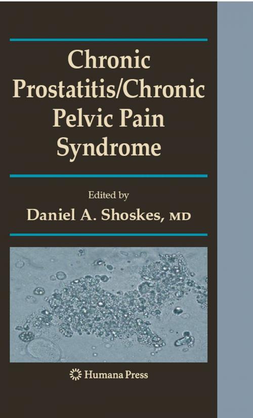 Cover of the book Chronic Prostatitis/Chronic Pelvic Pain Syndrome by , Humana Press