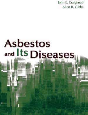 Cover of the book Asbestos and its Diseases by Sharon Schwartz, Ezra Susser, M.D., Alfredo Morabia, M.D., Evelyn J. Bromet