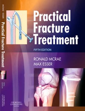 Cover of the book Practical Fracture Treatment E-Book by Sharon Stark, PhD, RN, APN-C