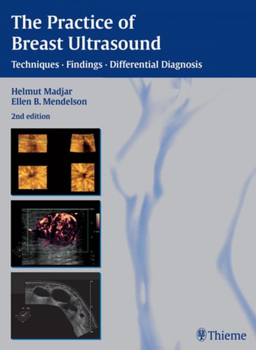 Cover of the book The Practice of Breast Ultrasound by Helmut Madjar, Ellen B. Mendelson, Thieme