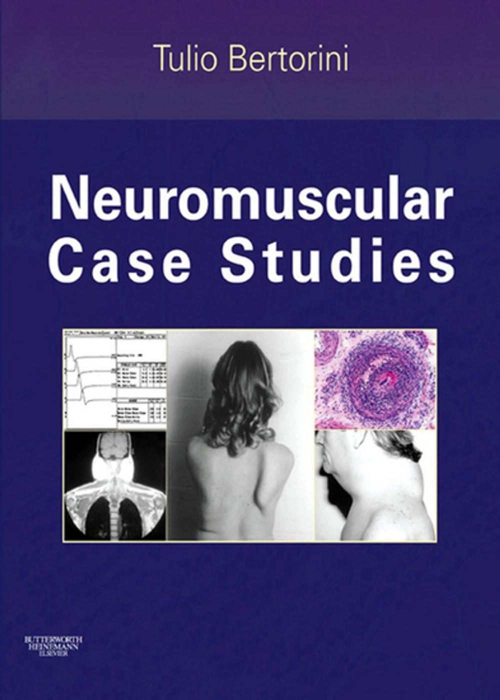 Big bigCover of Neuromuscular Case Studies E-Book