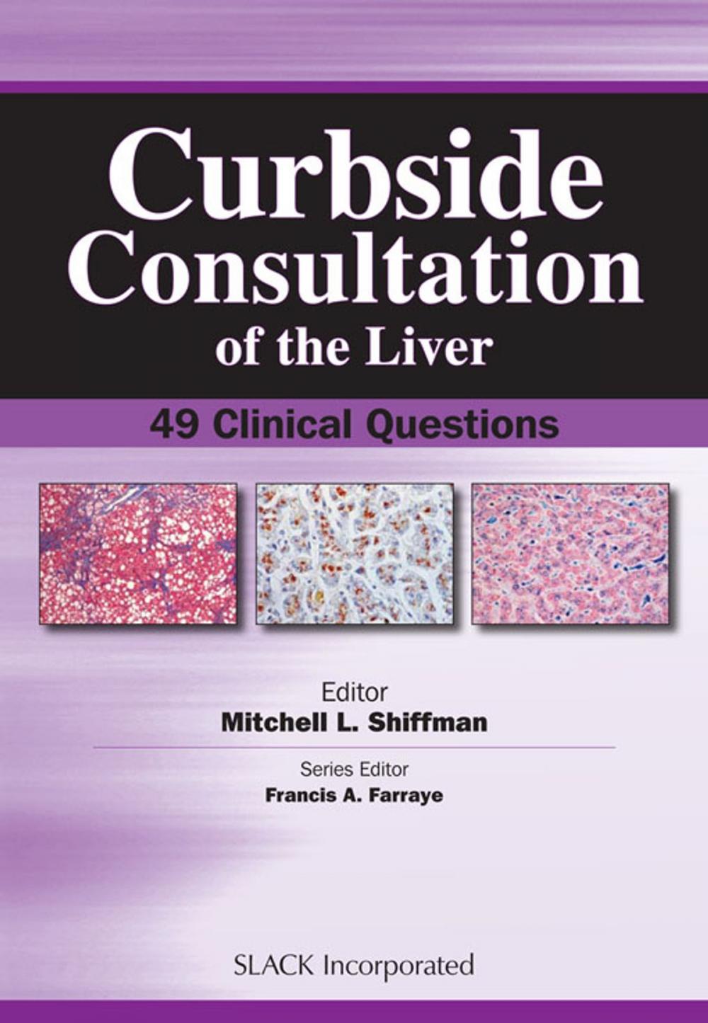 Big bigCover of Curbside Consultation of the Liver