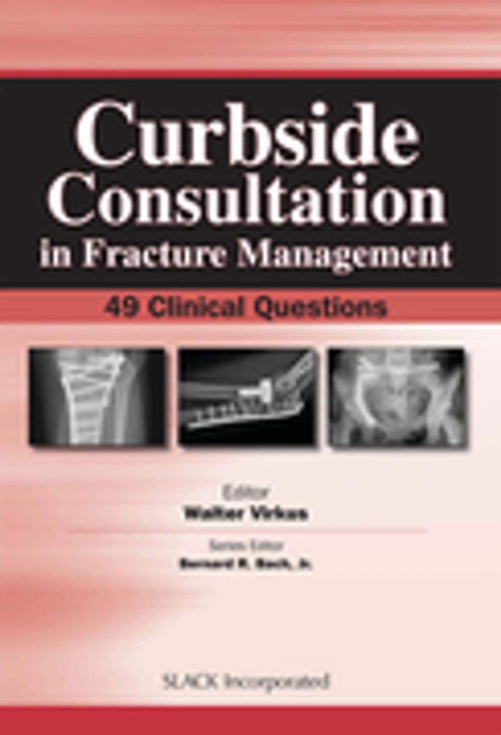 Big bigCover of Curbside Consultation in Fracture Management