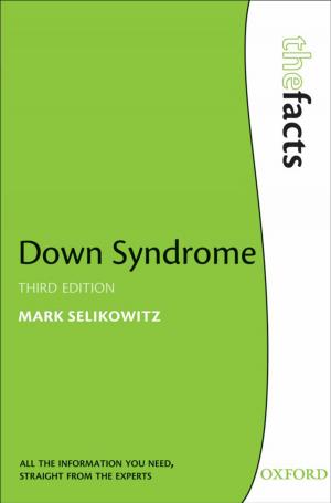Cover of the book Down Syndrome by Jonathan Slack