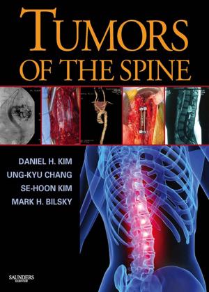 Cover of the book Tumors of the Spine E-Book by Mervyn Singer, MD, FRCP, Manu Shankar-Hari, MD, MSc, PhD, FFICM