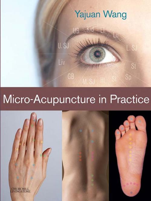 Cover of the book Micro-Acupuncture in Practice by Yajuan Wang, Elsevier Health Sciences