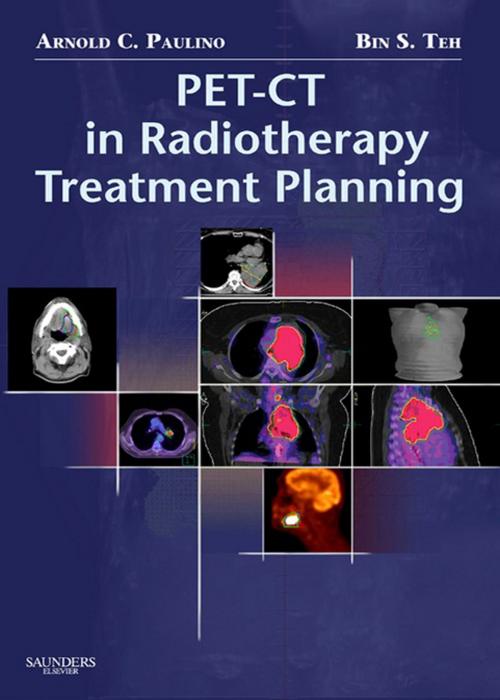 Cover of the book PET-CT in Radiotherapy Treatment Planning E-Book by Arnold C. Paulino, MD, Elsevier Health Sciences