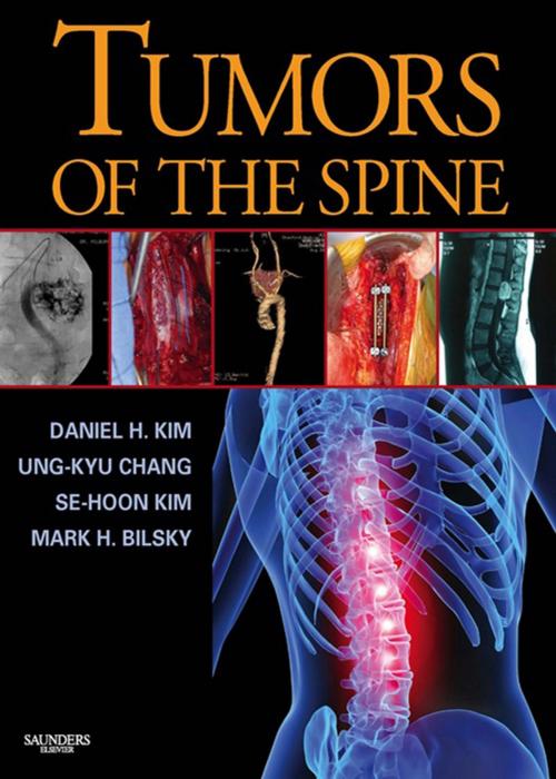 Cover of the book Tumors of the Spine E-Book by Mark H. Bilsky, MD, Daniel H. Kim, MD, FACS, Ung-kyu Chang, MD, PhD, Se-Hoon Kim, MD, PhD, Elsevier Health Sciences