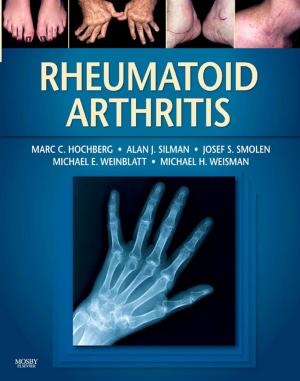 Book cover of Rheumatoid Arthritis E-Book