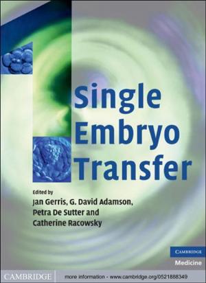 Cover of the book Single Embryo Transfer by Minoru Taya, Makoto Mizunami, Shûhei Nomura, Elizabeth Van Volkenburgh