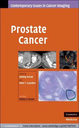 Cover of the book Prostate Cancer by Professor Margaret Brazier, Professor Suzanne Ost