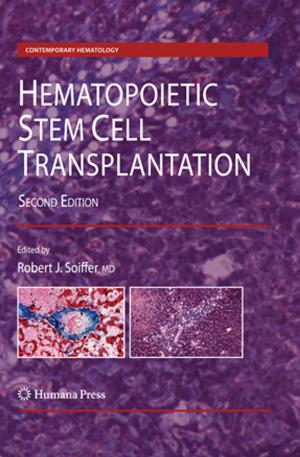 Cover of the book Hematopoietic Stem Cell Transplantation by 