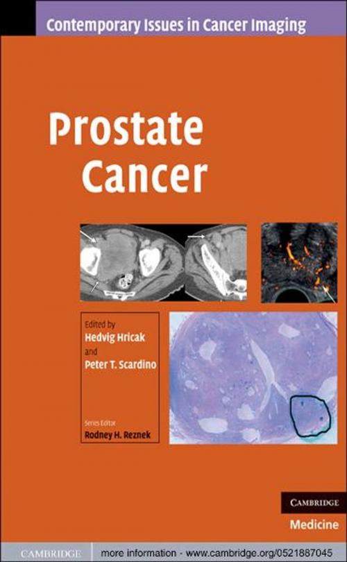 Cover of the book Prostate Cancer by , Cambridge University Press