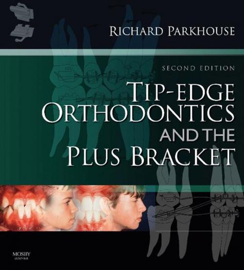Cover of the book Tip-Edge Orthodontics and the Plus Bracket E-Book by Richard Parkhouse, BDS(Hons Lond), FDS, DOrth, RCS(Eng), Elsevier Health Sciences