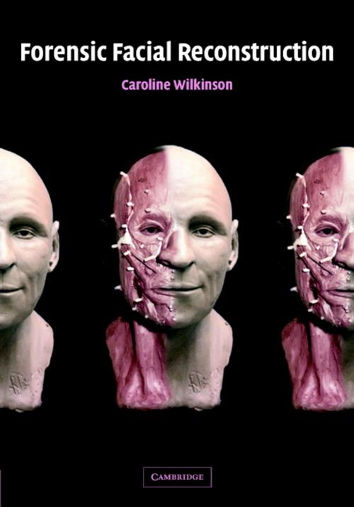 Cover of the book Forensic Facial Reconstruction by Caroline Wilkinson, Cambridge University Press