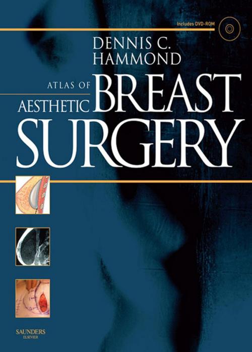 Cover of the book Atlas of Aesthetic Breast Surgery by Dennis C. Hammond, Elsevier Health Sciences