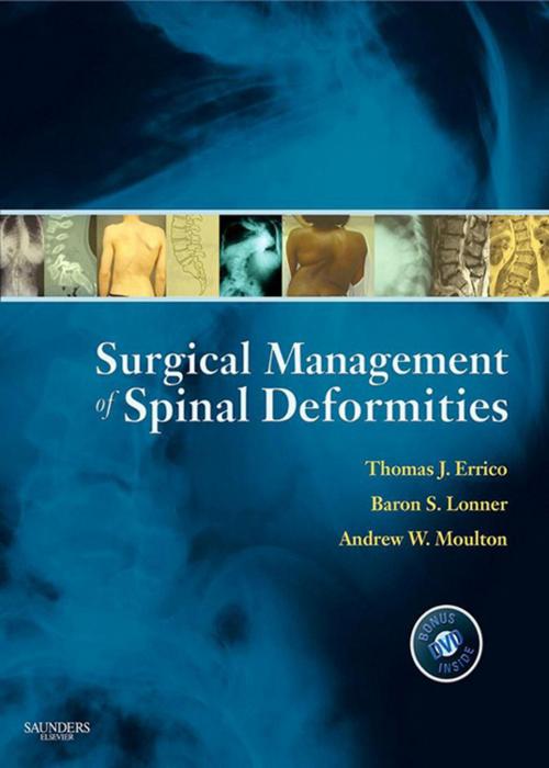 Cover of the book Surgical Management of Spinal Deformities E-Book by Andrew W. Moulton, MD, Thomas J. Errico, MD, Baron S. Lonner, MD, Elsevier Health Sciences